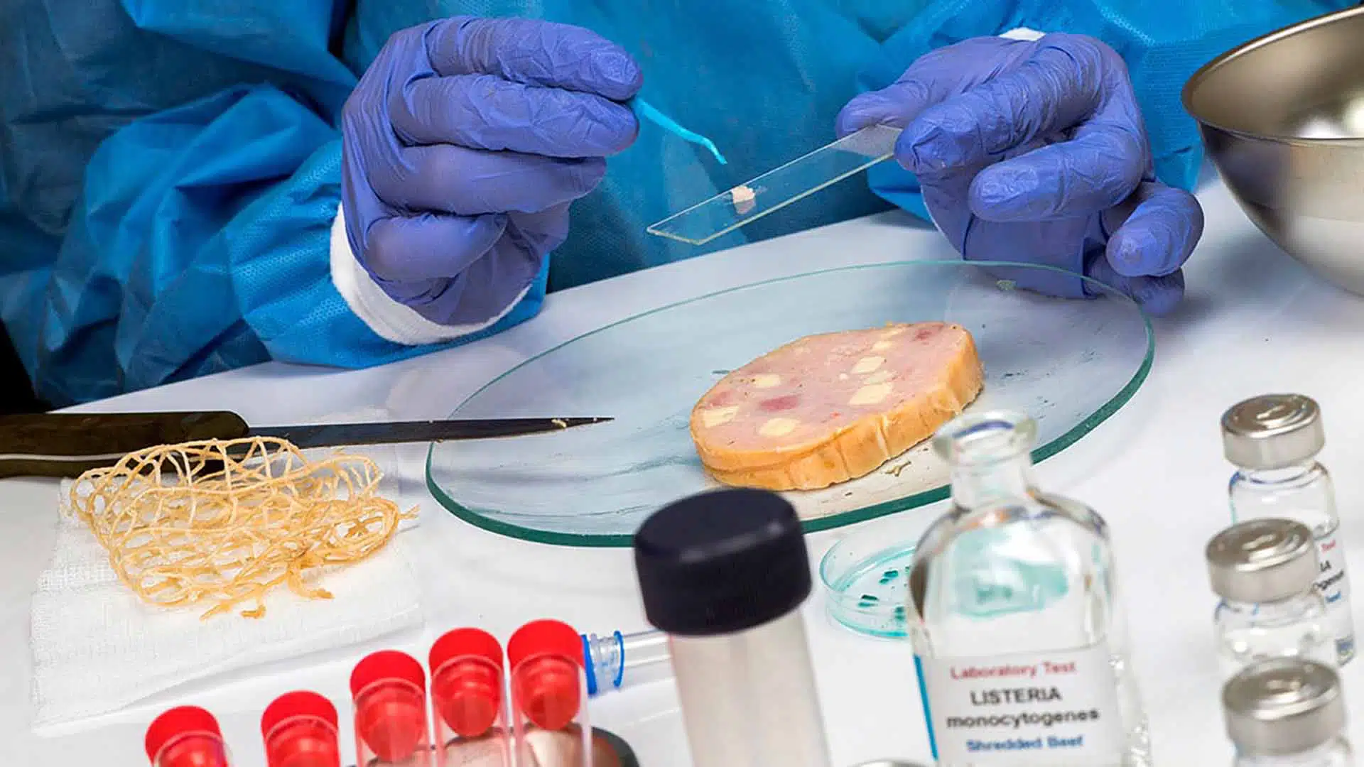 Listeriosis